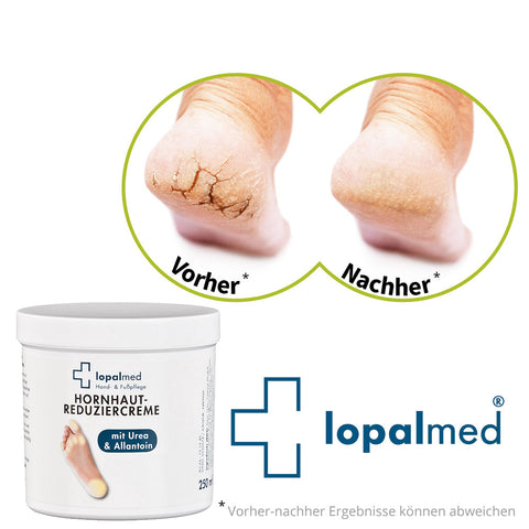 Lopalmed Hornhaut Reduziercreme